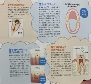 歯科受診が口臭対策の早道です。 歯科受診が口臭対策の早道です。