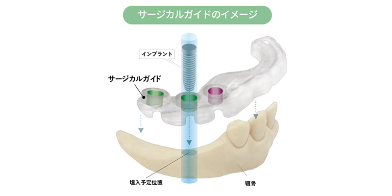 痛みや腫れを抑えたい場合への対応