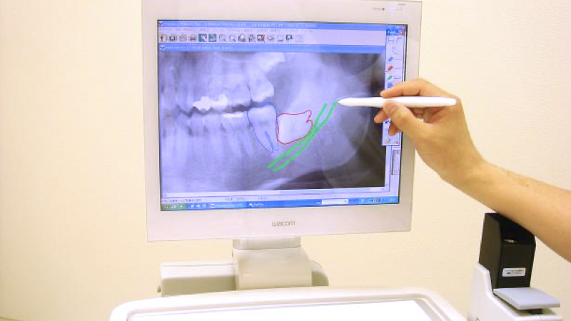 レントゲンに直接書き込めるタッチペンモニター