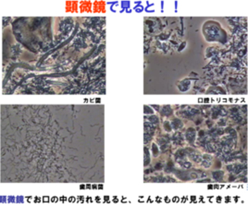 まずは歯を残す方法を検討する