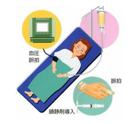 静脈内鎮静法
